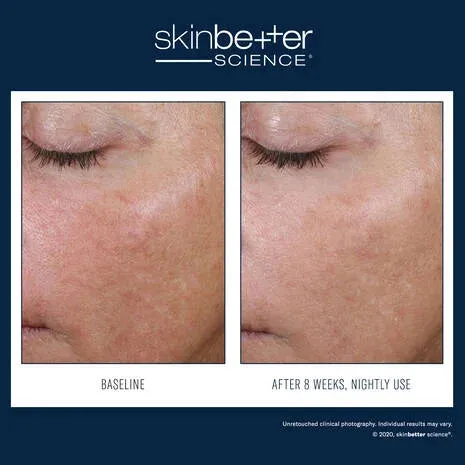 Skinbetter Science AlphaRet Overnight Cream